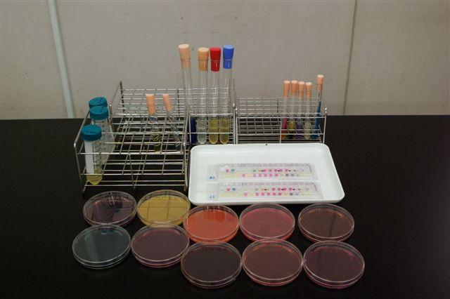 細菌検査に使用する1検体分の培地